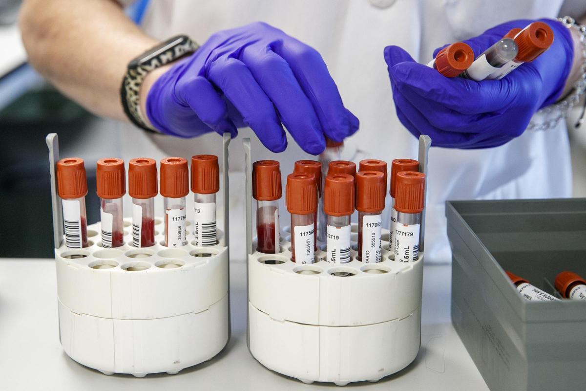 Personal de laboratorio prepara muestras para analizar si hay sarampión.