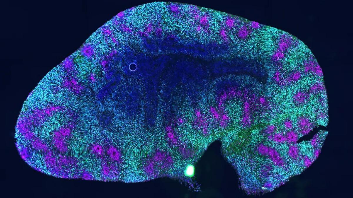 La sección transversal de un mini cerebro de 90 días hecho de células madre muestra por primera vez que los organoides cerebrales pueden envejecer.