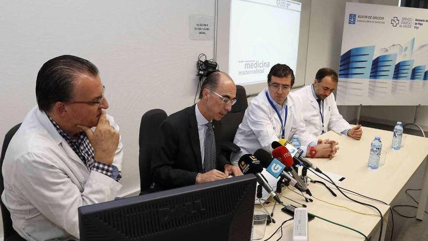 López Ramón y Cajal, Vázquez Almuiña, Rubial y Comesaña en la presentación del proyecto. // FdV