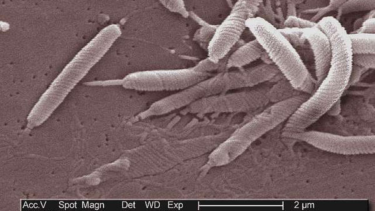 Helicobacter pylori, quizás la bacteria más presente en el mundo