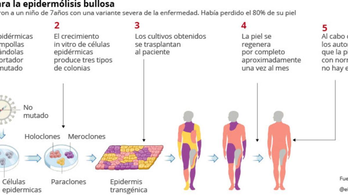 terapia