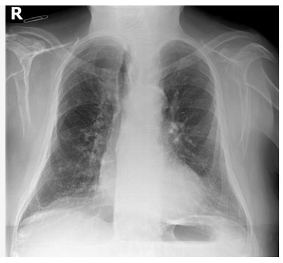 La única prueba que se le realizó fue una radiografía