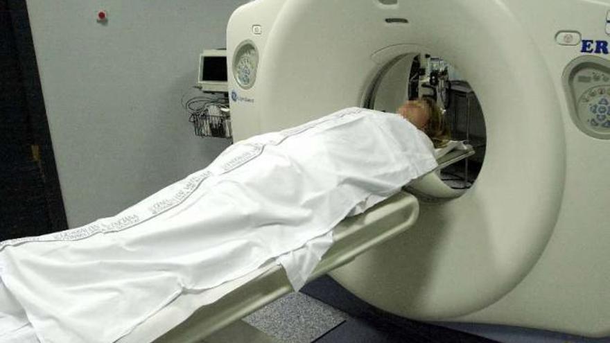Cada año se detectan en España unos 3.000 nuevos casos de tumores cerebrales