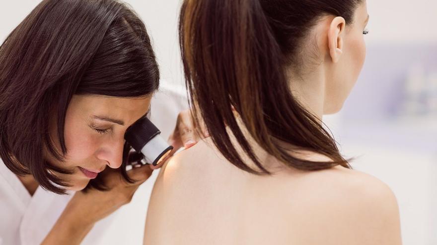 Investigadores españoles descubren varias proteínas implicadas en la progresión del melanoma