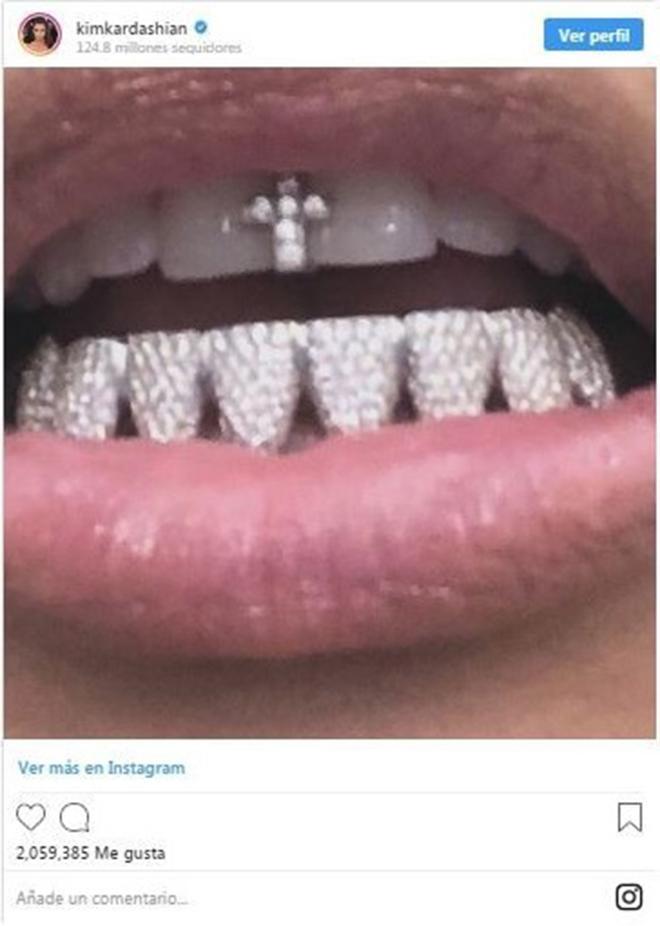 Dentadura de diamantes de Kim Kardashian