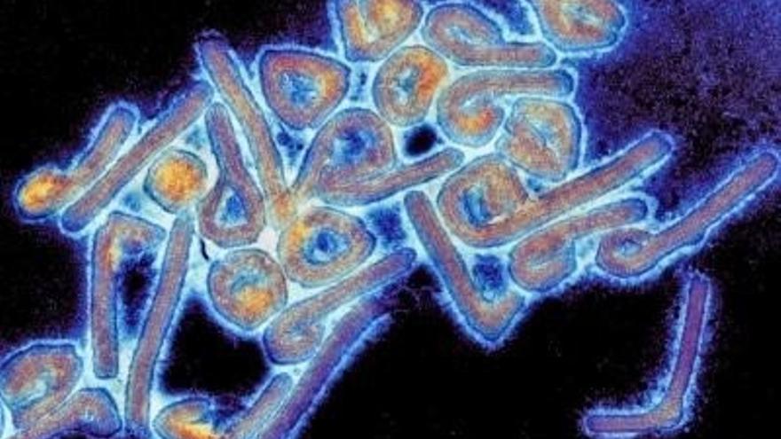 Detectan el primer caso del virus de Marburgo, parecido al ébola, en Guinea