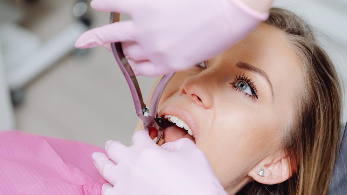 Agenesia dental, un problema de todas las edades que es importante corregir