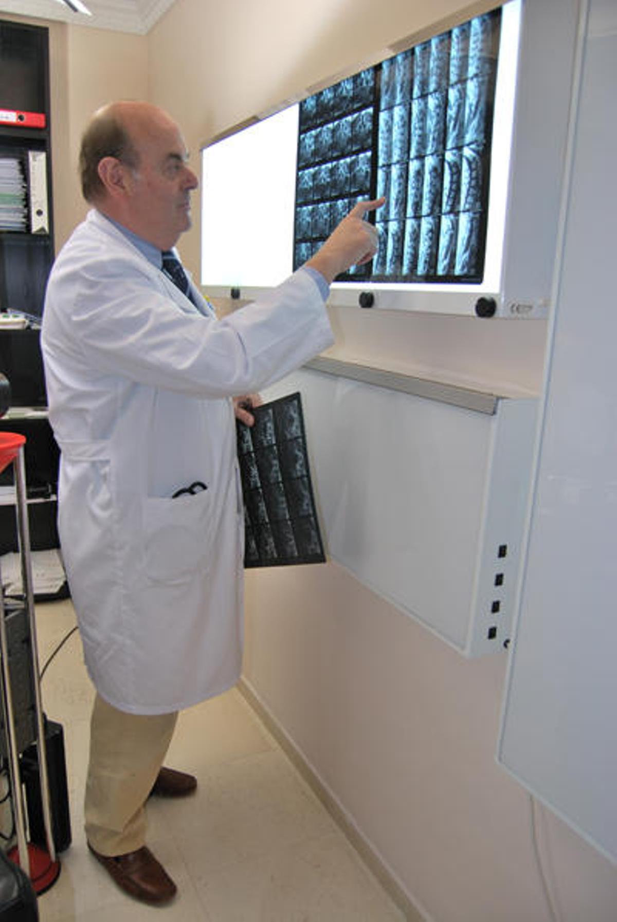 Confianza. El doctor Cortés-Funes revisando una radiografía.