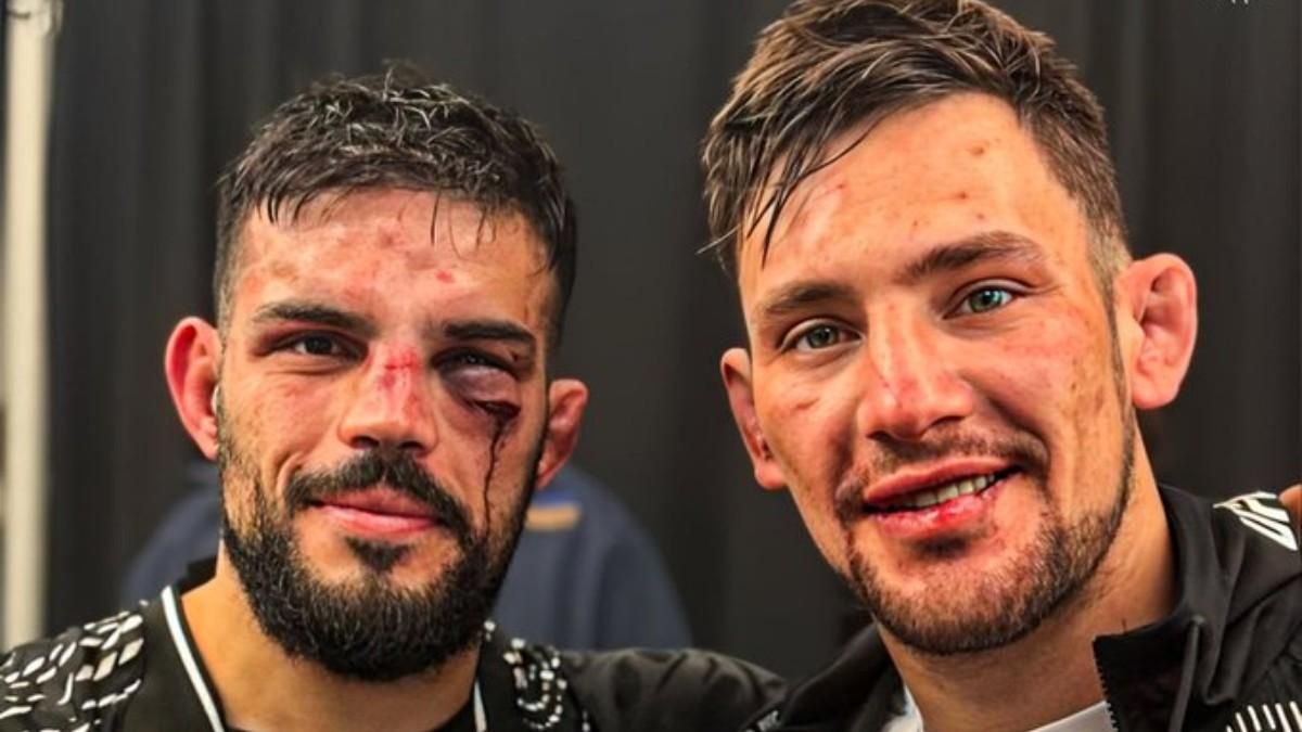 Los rostros magullados de Haqsparat y Ribovics tras su combate