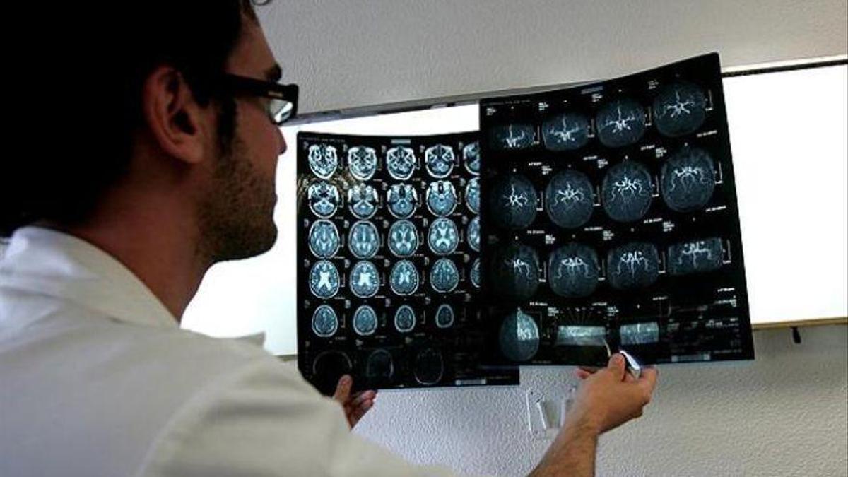 Un sanitario consultando unas pruebas por imagen de un cerebro.