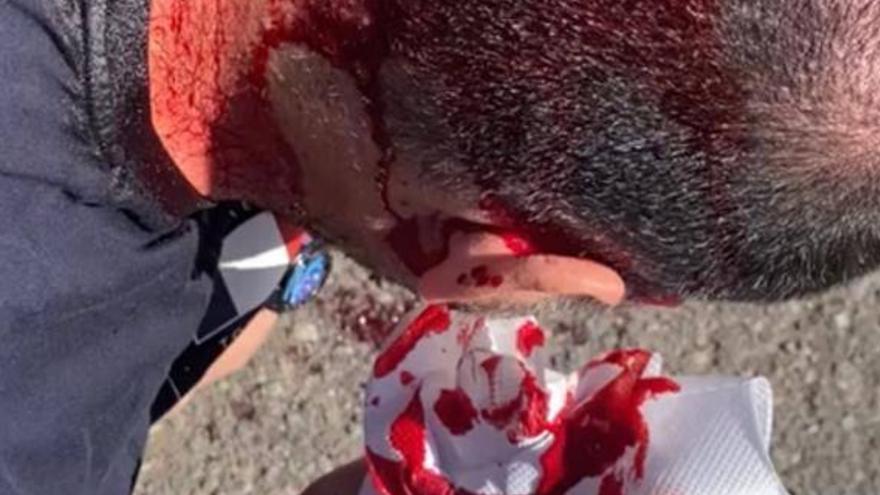 Rompe un bate de béisbol en la cabeza de un policía por mediar en una reyerta vecinal en Gran Canaria