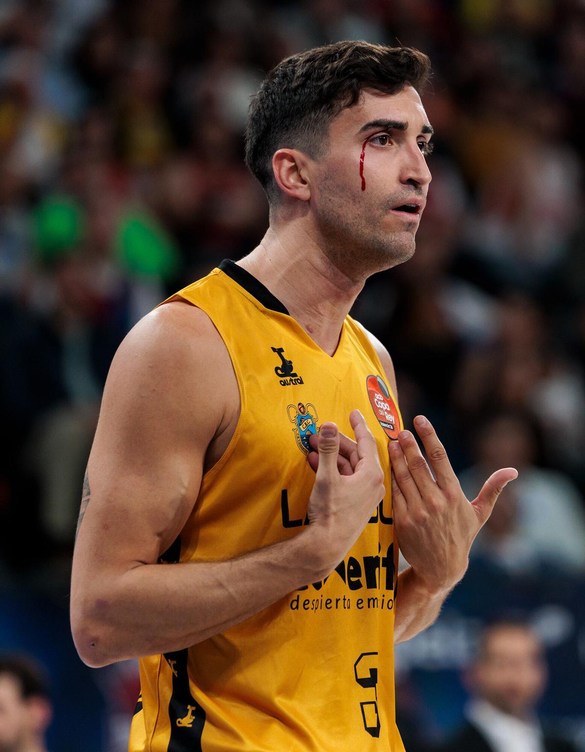 Jaime Fernández, golpeado y sangrando, incrédulo tras ser sancionado con falta.