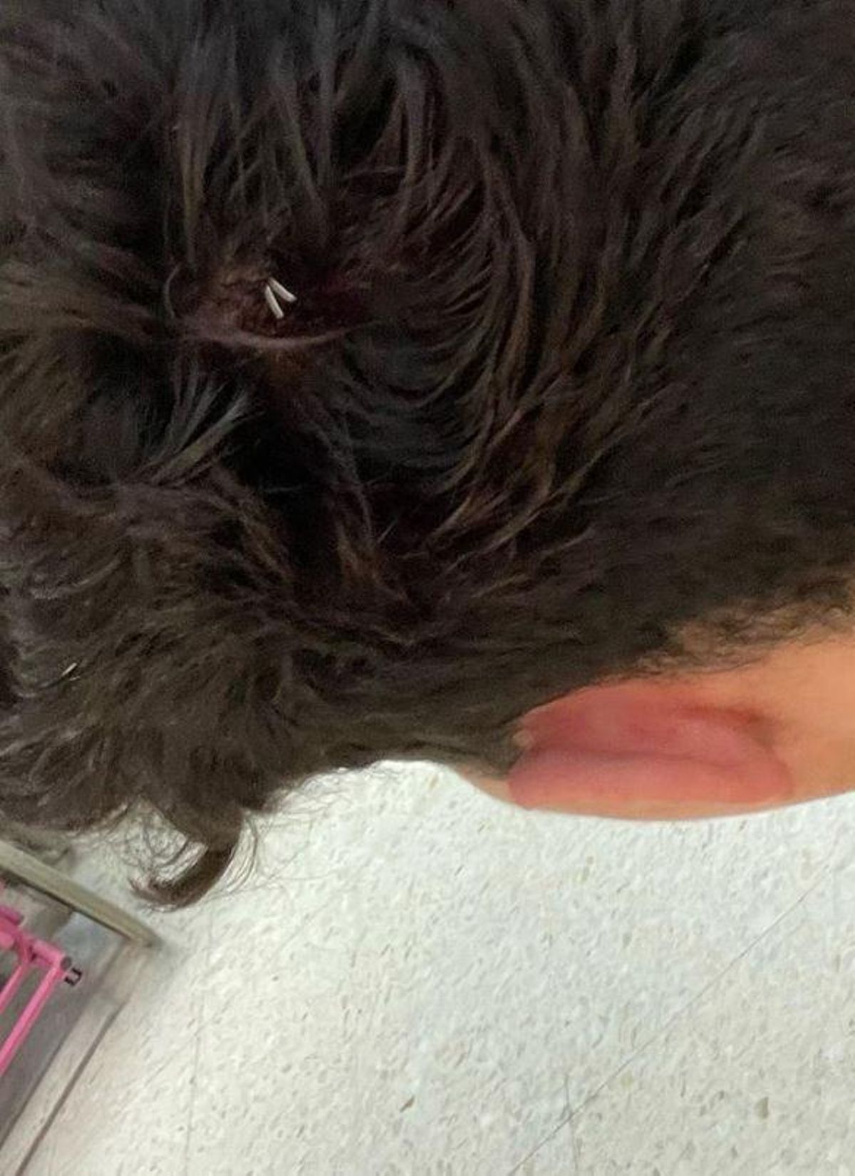 Ángel también sufrió un traumatismo craneal por la paliza