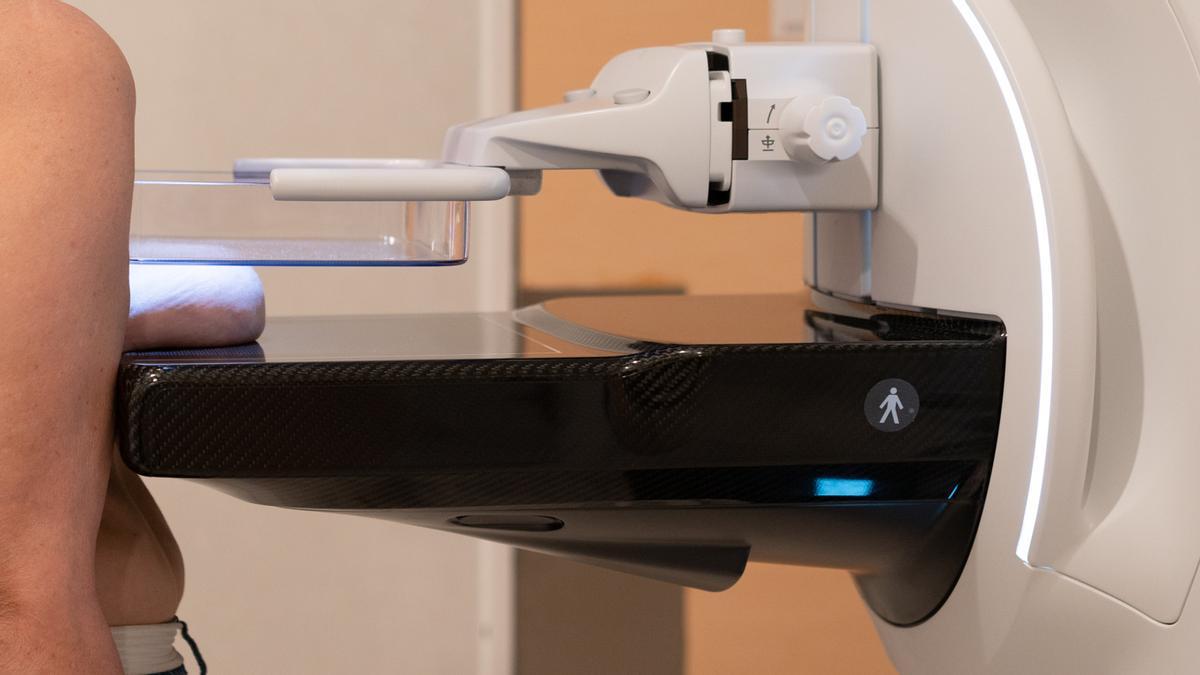 El nuevo mamógrafo con tecnología 3D