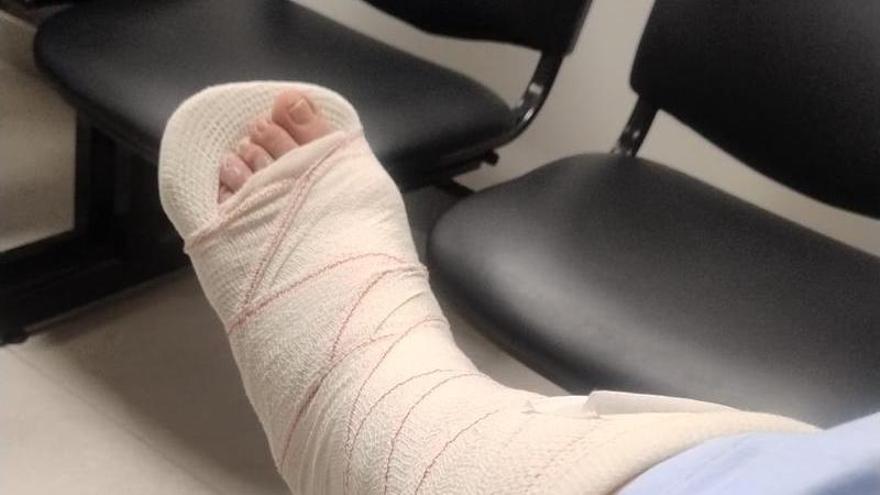Una exconcejala de Alicante se fractura un pie al caerse en una acera en Alicante