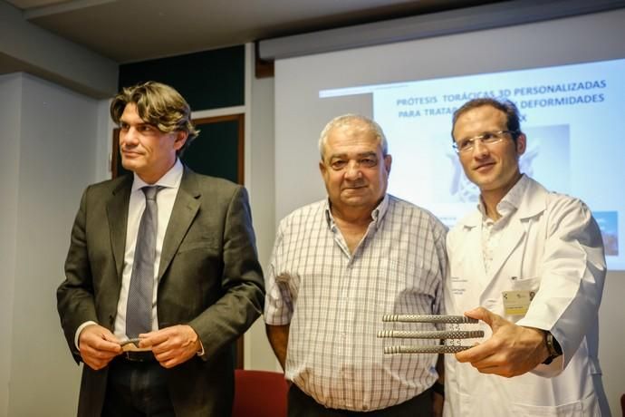 Las Palmas de Gran Canaria . Presentación de resultados del sistema de prótesis torácicas 3D.  | 05/02/2020 | Fotógrafo: José Carlos Guerra