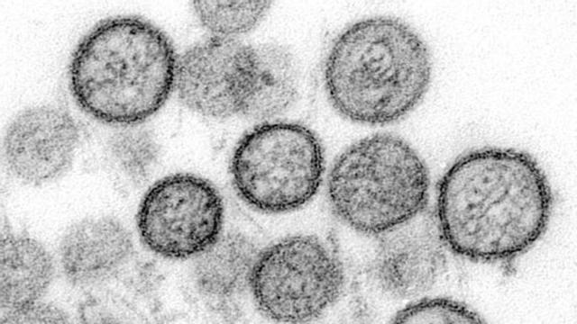 Un tipo de hantavirus visto a través del microscopio. | CDC / Cynthia Goldsmith