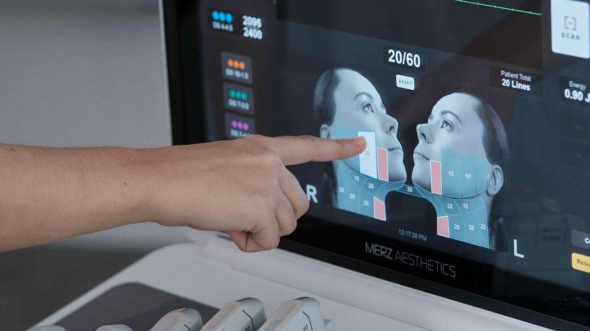 Vinícius Júnior se sometió a una mentoplastia y armonización facial en julio de 2026.