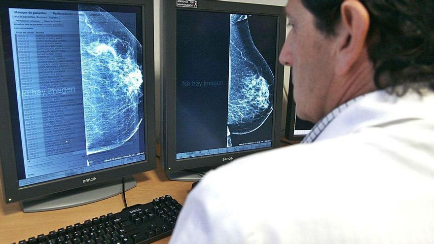 Andalucía recibió más de 700.000 euros para proyectos de investigación del cáncer de mama