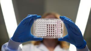 Una nueva combinación farmacológica ha demostrado eficacia en alargar la supervivencia en pacientes con cáncer de páncreas avanzado que no pueden ser operados, en uno de los tumores con peor pronóstico.EFE/ Alejandro García