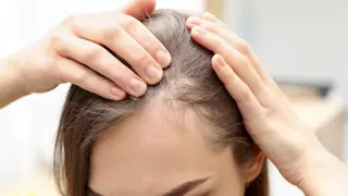 Una dermatóloga de Vigo alerta del aumento de caída del pelo por el brote de COVID de este verano