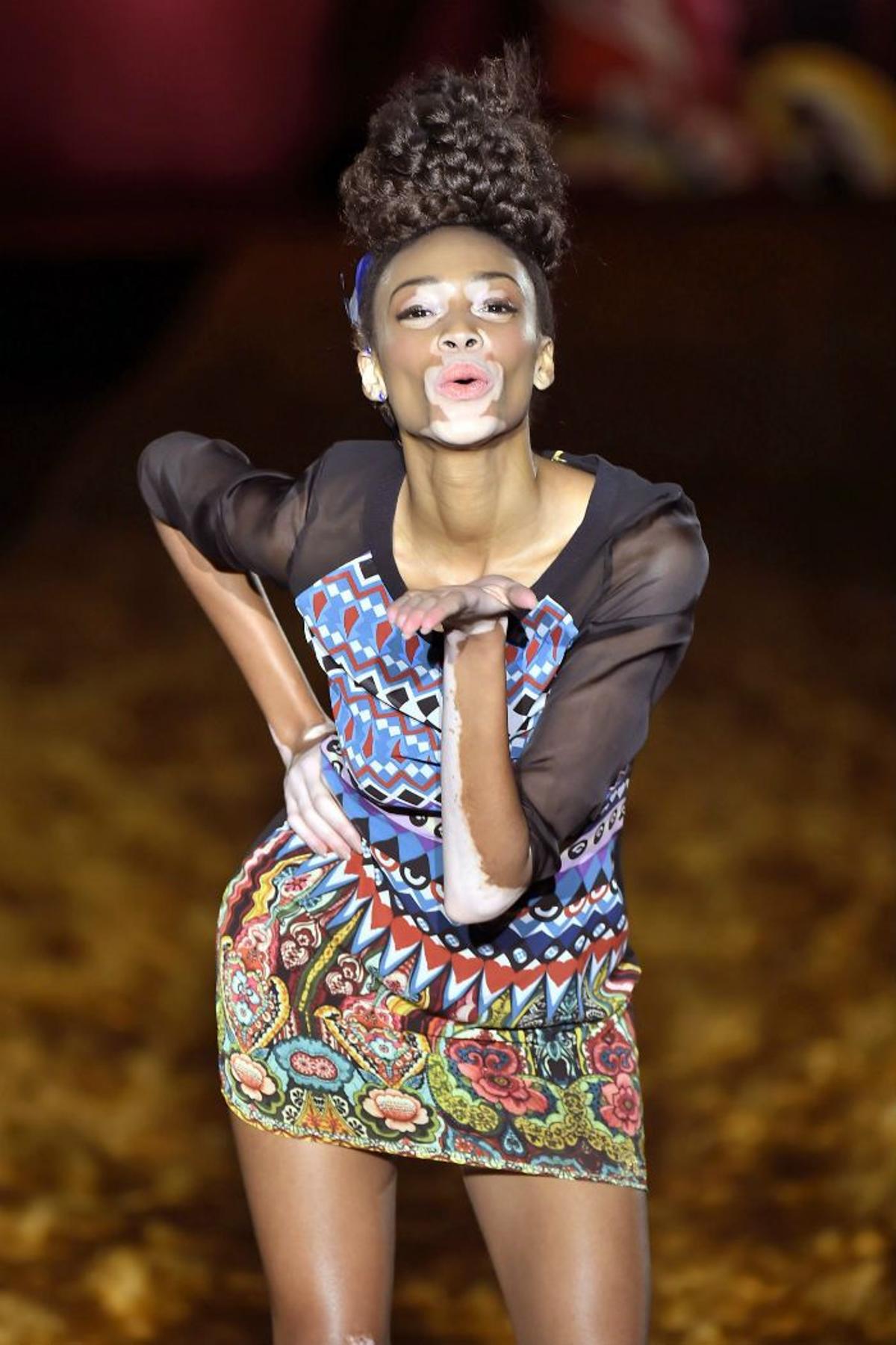 Desigual otoño-invierno 2015/16, Winnie Harlow