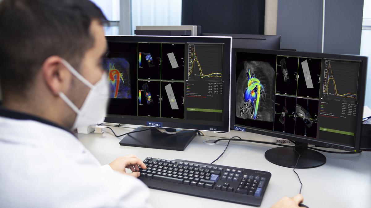 4DTools permite crear una réplica virtual de la aorta, específica de cada paciente, para  anticipar escenarios clínicos e incrementar la precisión.