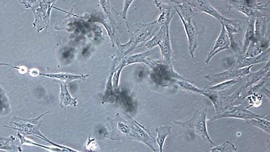 Un equipo médico de Barcelona logra regenerar el tendón de Aquiles sin cirugía mediante células madre cultivadas: 