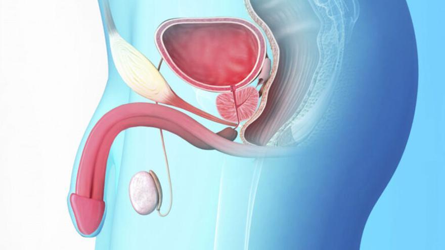 Día Mundial del Cáncer de Próstata: Más de 20.000 casos diagnosticados cada año