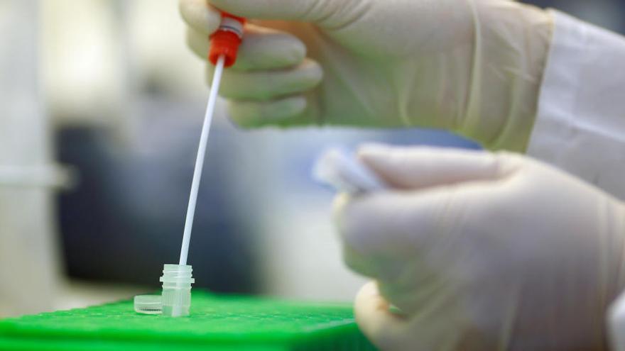 Las pruebas rápidas mejorarán la capacidad limitada de los análisis PCR que exigen laboratorio.