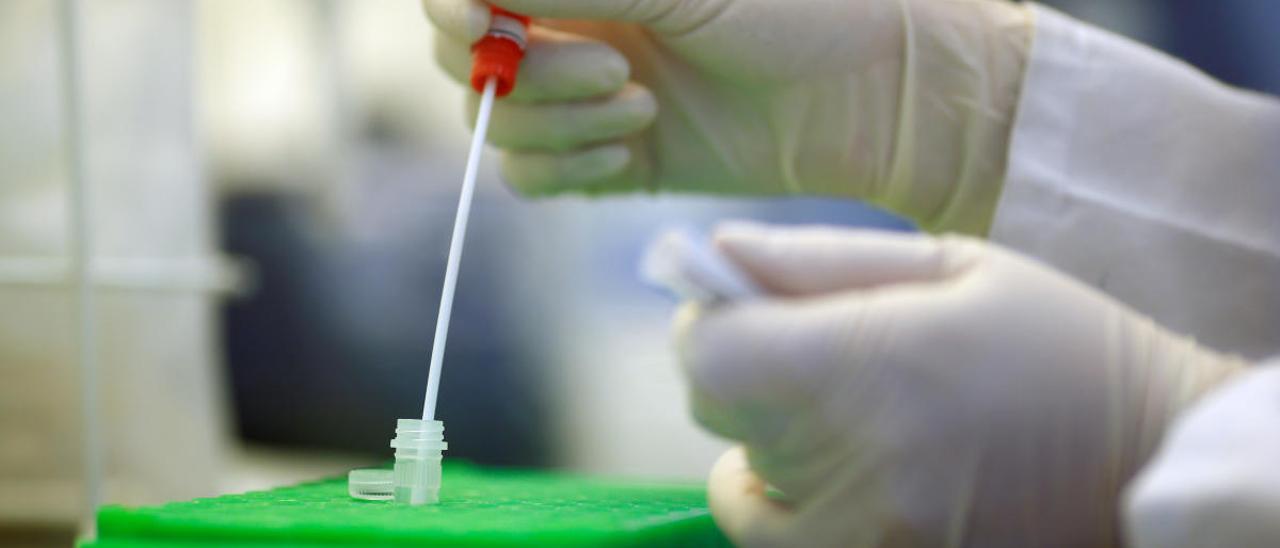 Las pruebas rápidas mejorarán la capacidad limitada de los análisis PCR que exigen laboratorio.