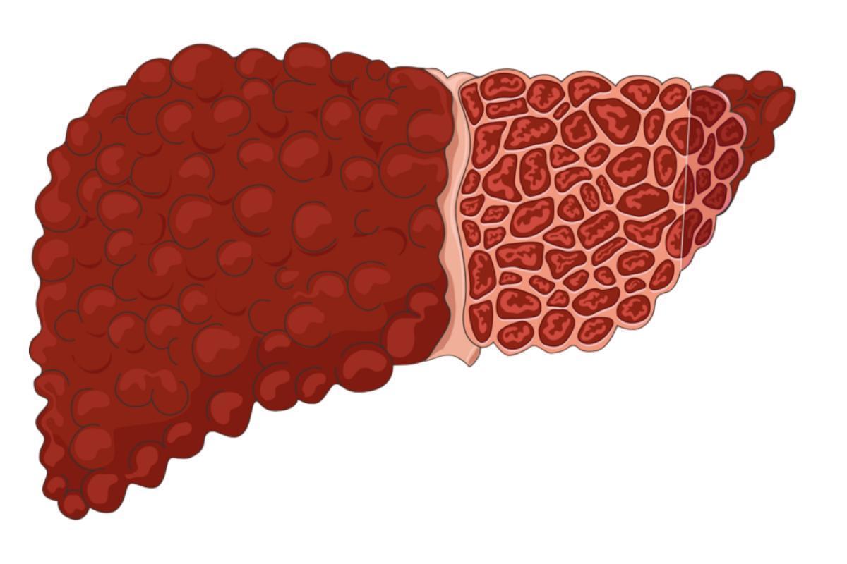 Una bacteria, aislada de individuos delgados, puede ayudar a adelgazar a personas obesas