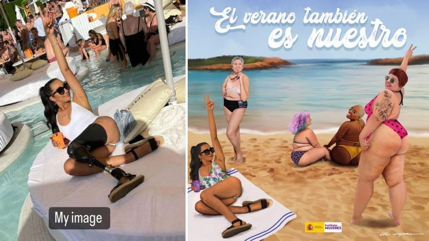 &quot;Sommer gehört allen Frauen&quot;: Grafiker retuschierten in Kampagne gegen Diskriminierung Beinprothese weg