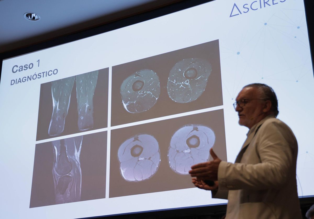 El Dr. Eduardo Zaragozá explica las imágenes de un caso clínico en el foro.
