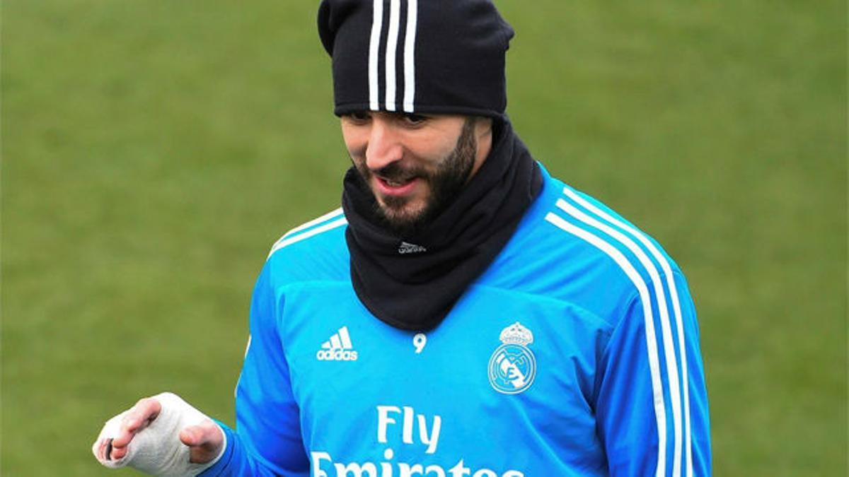 Benzema volvió a entrenar con vendaje en la mano