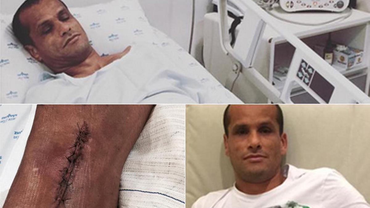 Rivaldo enseñó su cicatriz