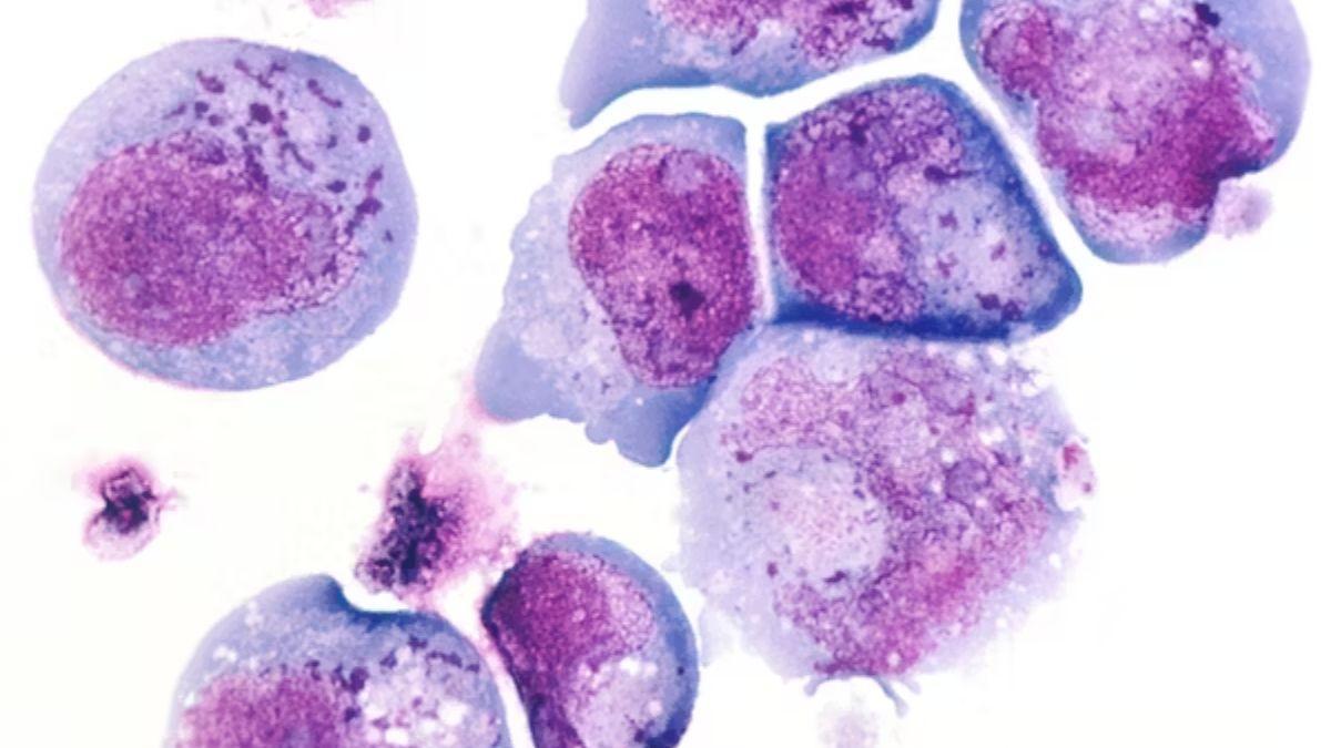 Los cuerpos de color magenta en esta micrografía del herpesvirus 6, son agregados de proteínas que forman un tipo de condensado biomolecular.