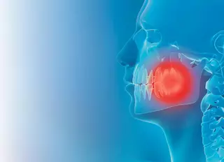 El diagnóstico precoz del cáncer oral puede salvar tu vida
