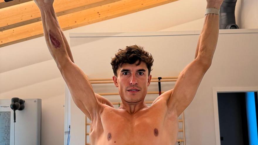Hartes und erschütterndes erstes Bild des rechten Arms von Marc Márquez