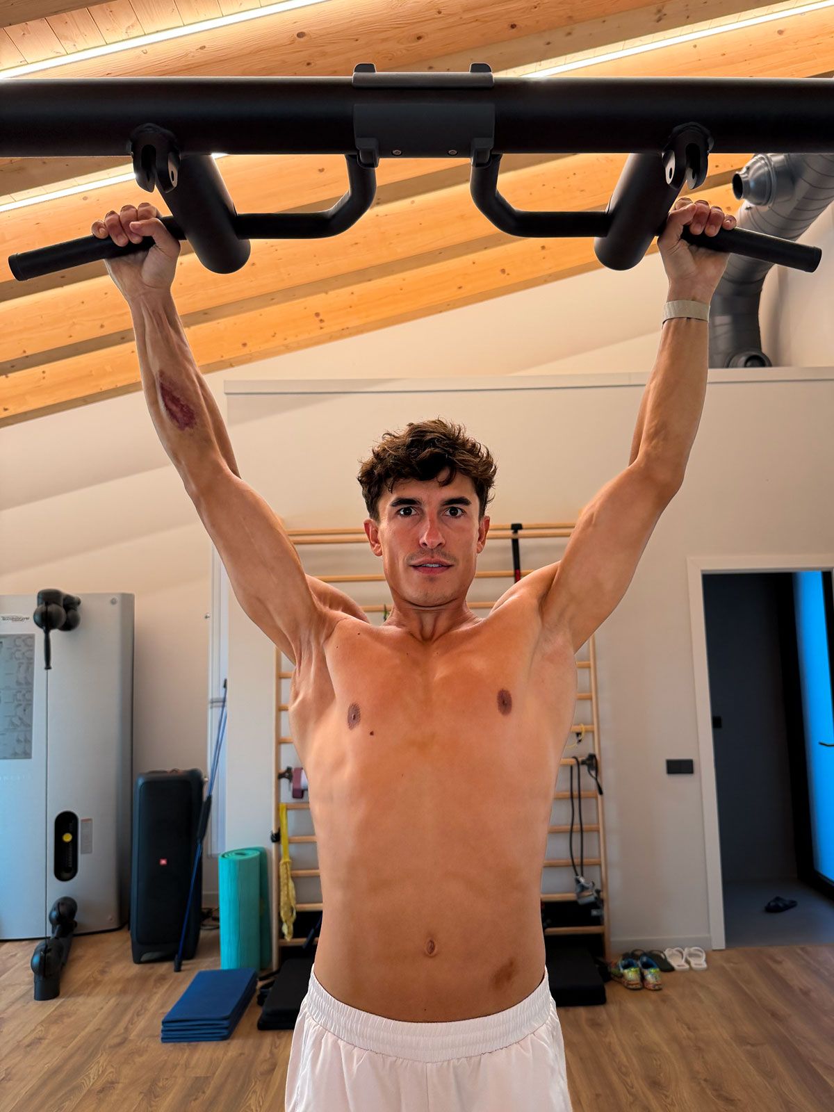 Espectacular imagen del brazo derecho de Marc Márquez, que el campeón catalán acaba de publicar en su Instagram donde se aprecia, claramente, la diferencia con el brazo izquierdo.