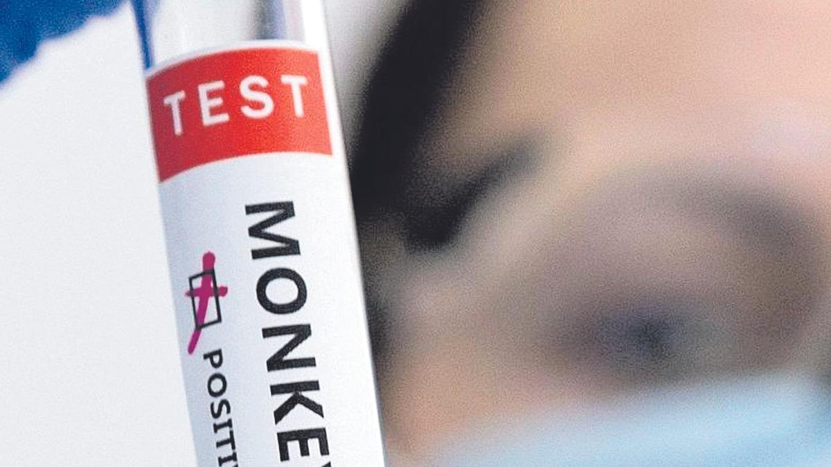 Una enfermera muestra un test positivo de la viruela del mono.