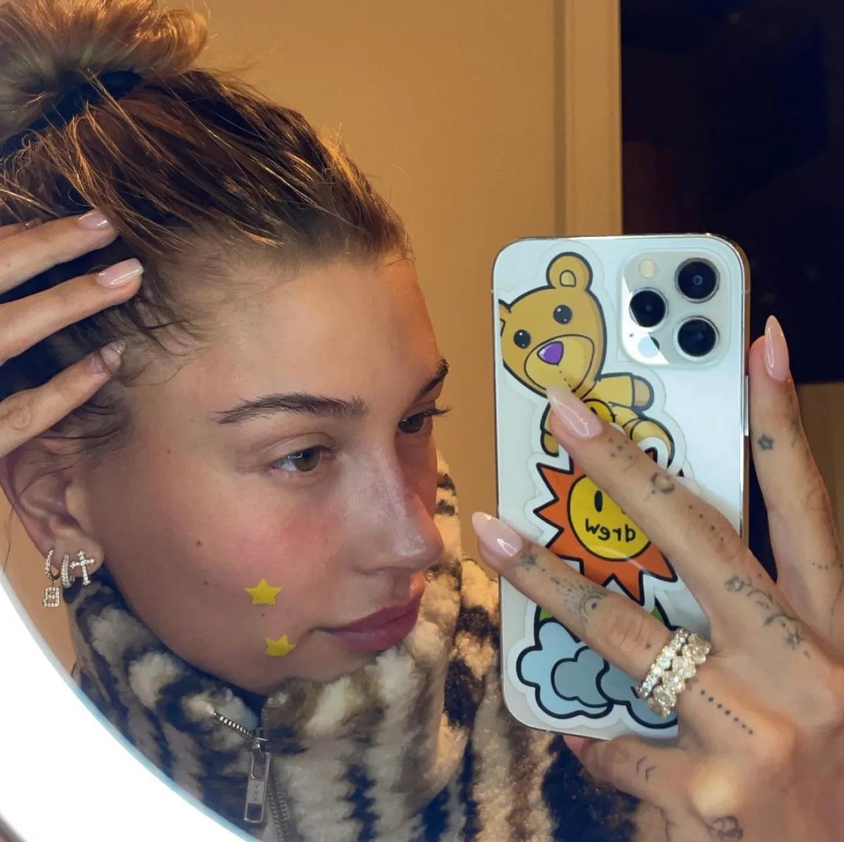 Hailey Bieber, con los parches antiacné Starface.