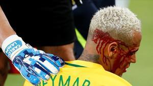 Neymar, tras recibir el codazo ante Bolivia.