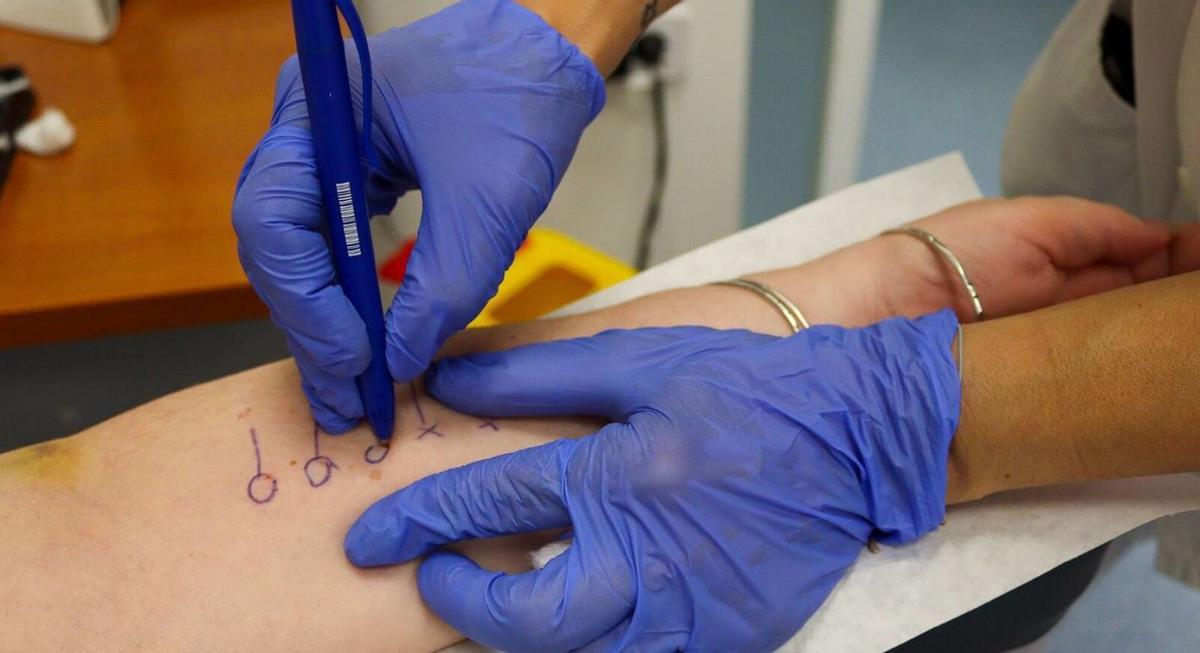 Realizan pruebas a un paciente en la Unidad Multidisciplinar de Patologías Mastocitarias del Hospital Civil. | L.O.