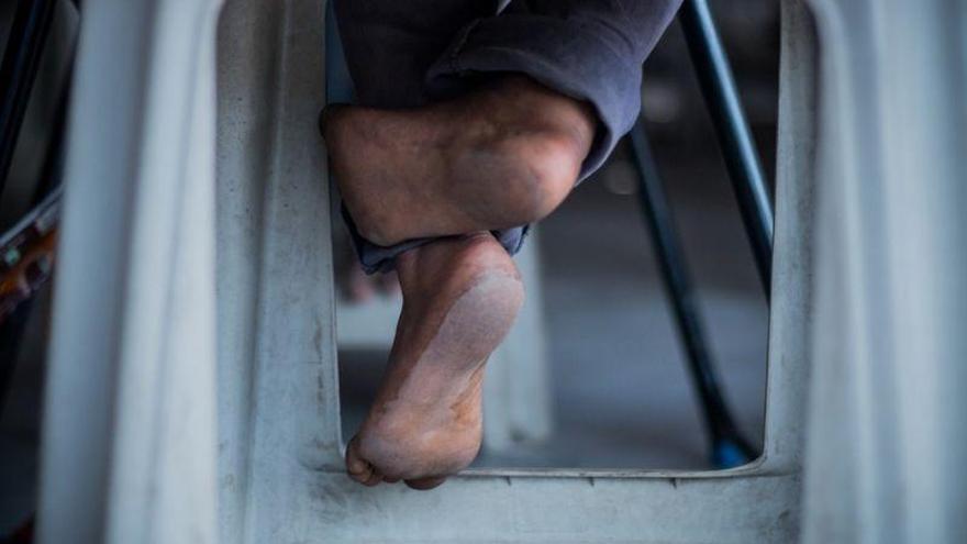 Detenido un hombre en la India por el mal olor de sus pies