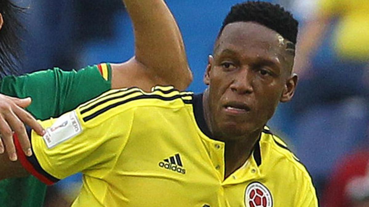 Yerry Mina tendrá que pasar por el quirófano