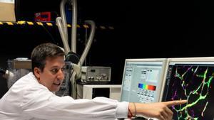 Descoberta científica d’una via per prevenir la metàstasi cerebral