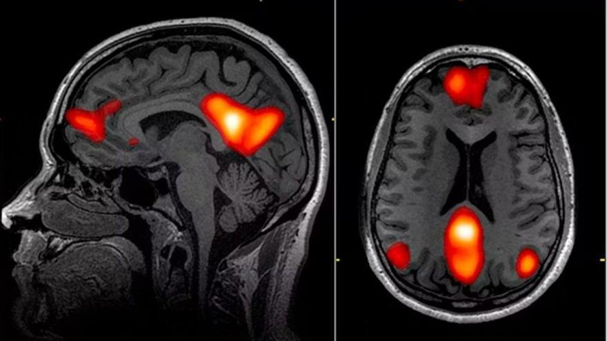 Descubren cómo la consciencia individual nos hace únicos