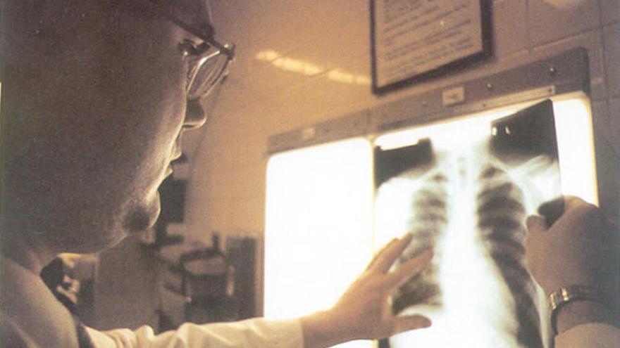 Un metge inspecciona una radiografia en una imatge d&#039;arxiu.