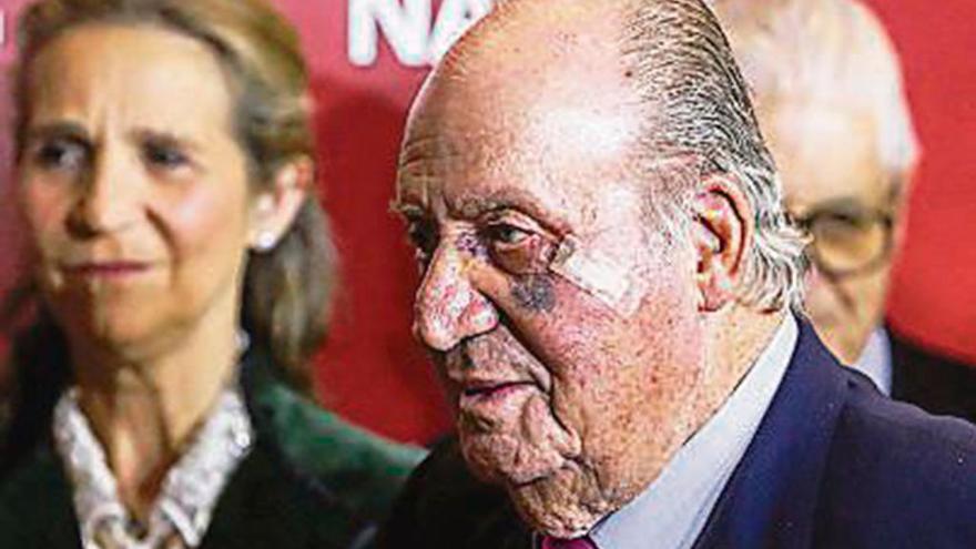 El Rey emérito Don Juan Carlos con el ojo morado // Ricardo Rubio